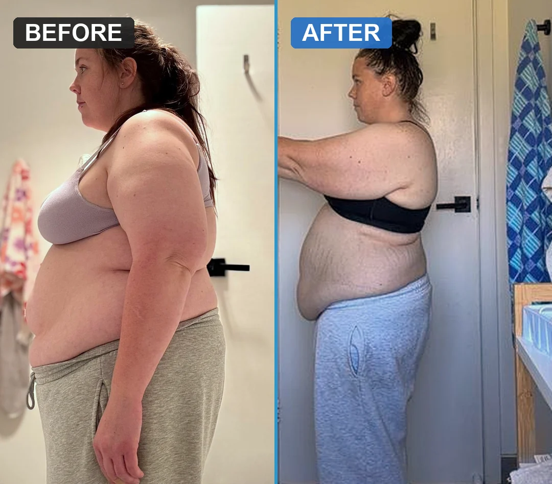 An Evolve before and after, 9