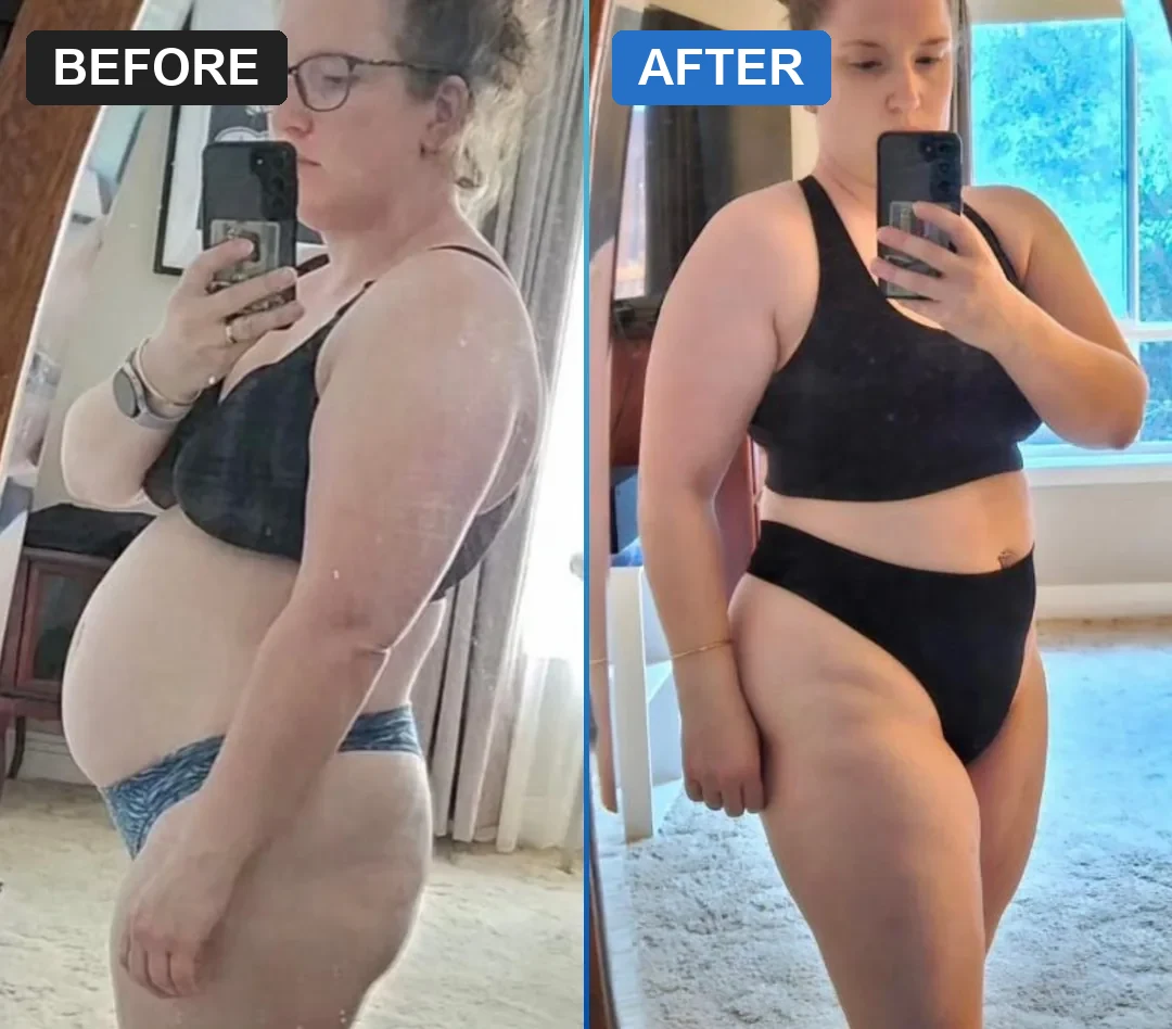 An Evolve before and after, 3